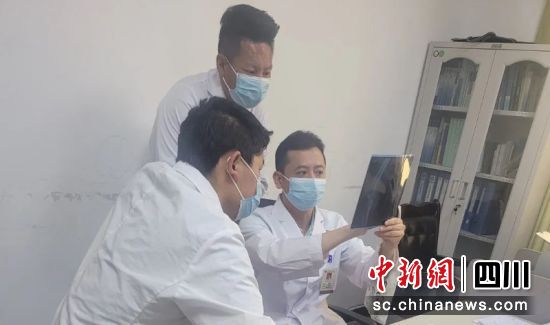 正在一起研究病情。成都市第三人民醫院 供圖 正在一起研究病情。成都市第三人民醫院 供圖